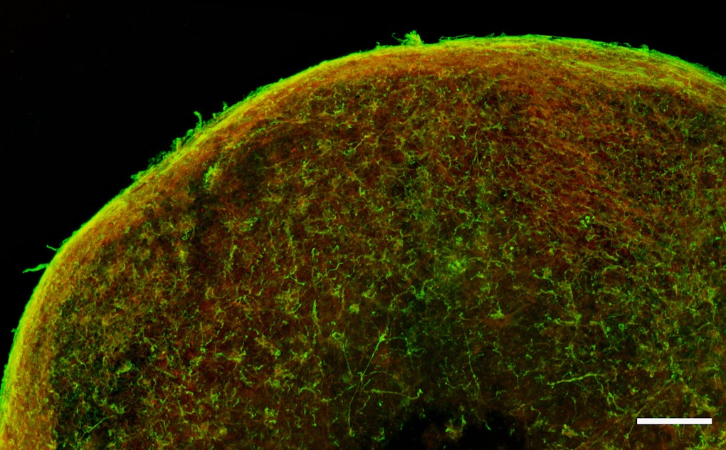 Modelli di cellule 3D per studiare meglio il Parkinson