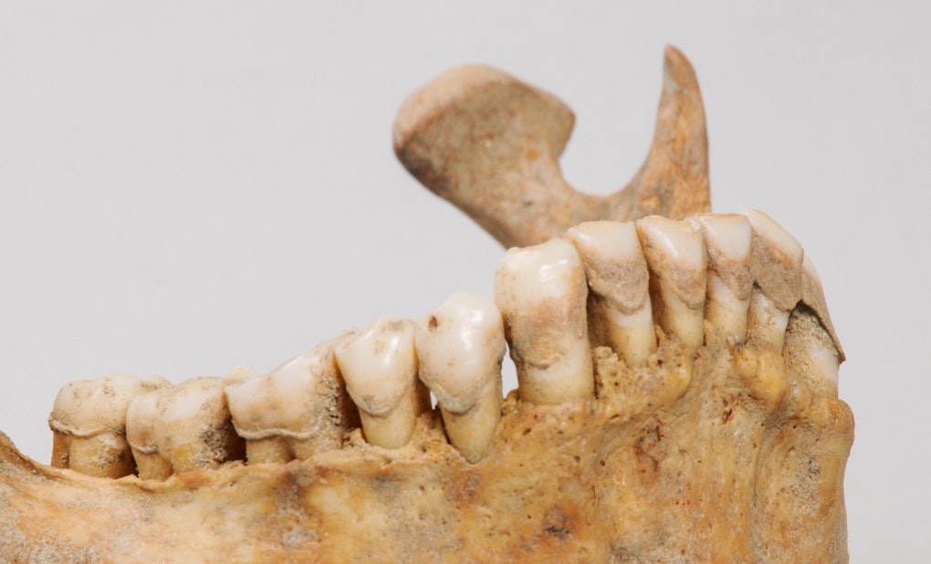 Image showing ancient dental calculus