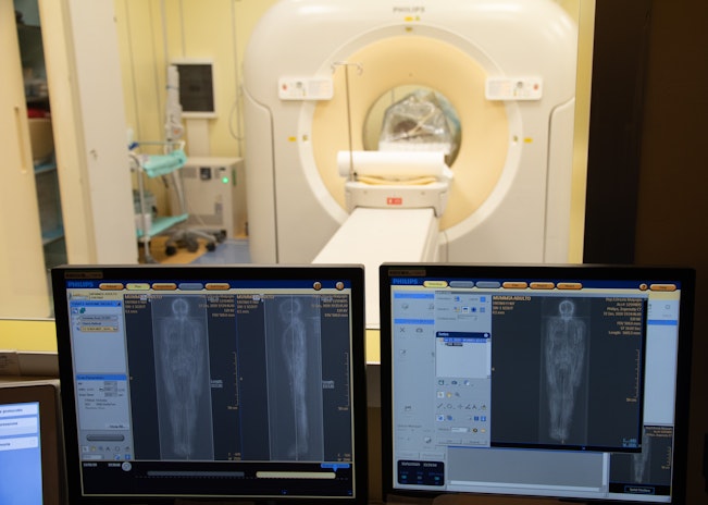 Immagini della tomografia assiale computerizzata (TAC)