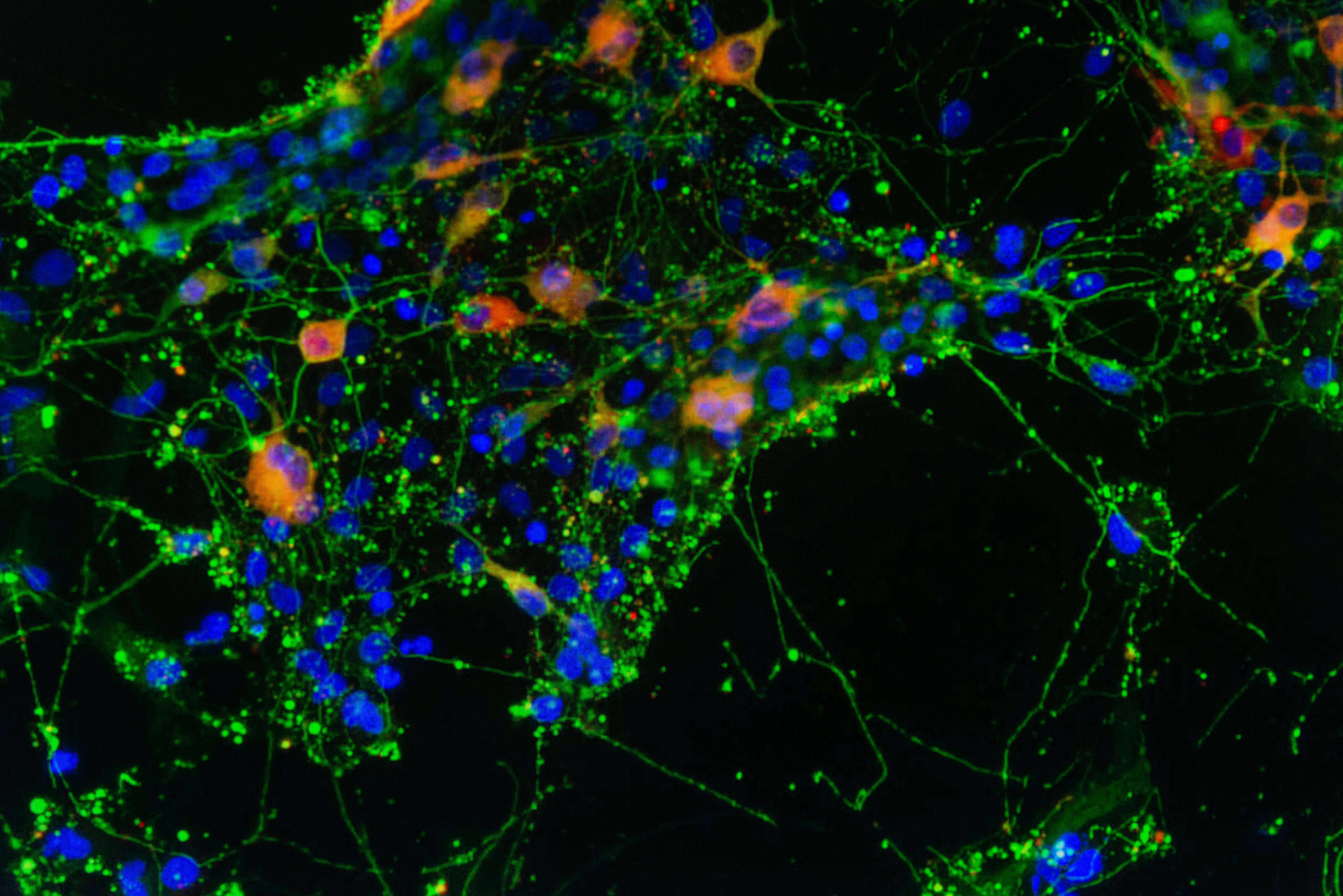 Piccoli grumi, enorme potenziale - Eurac Research, image size:1920x1080