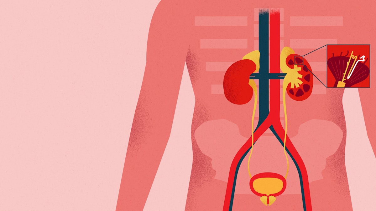 Filtering Data on Kidney Function - Eurac Research