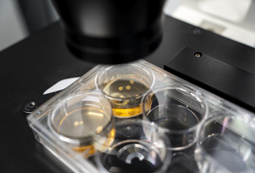 Investigating Parkinson’s Disease with organoids